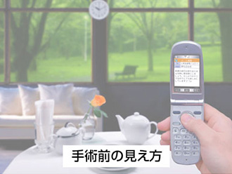 手術前の見え方