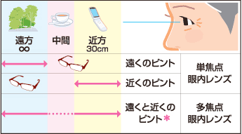 眼内レンズ挿入後のピント